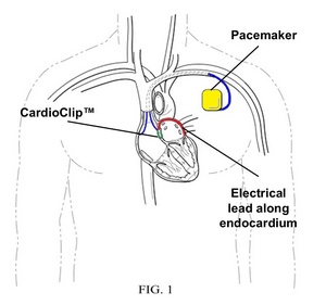 Image of the Wolf CARDS multifunction device